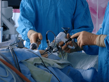 Intervention chirurgicale